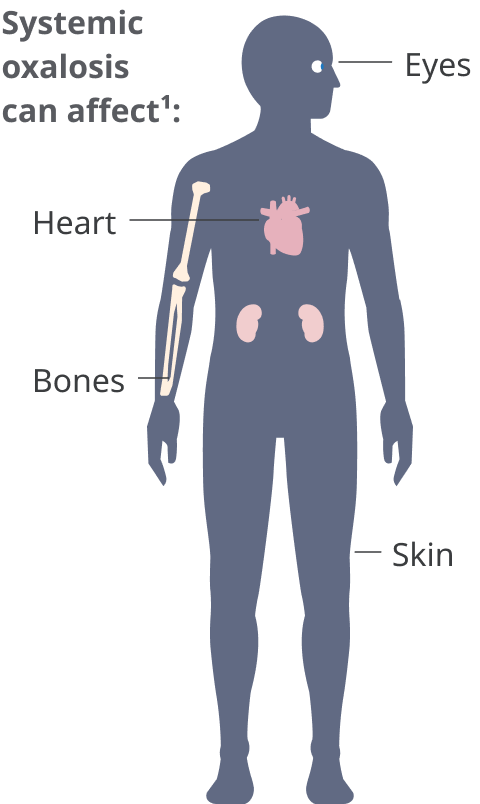 Body with eyes, heart, bones, and skin highlighted